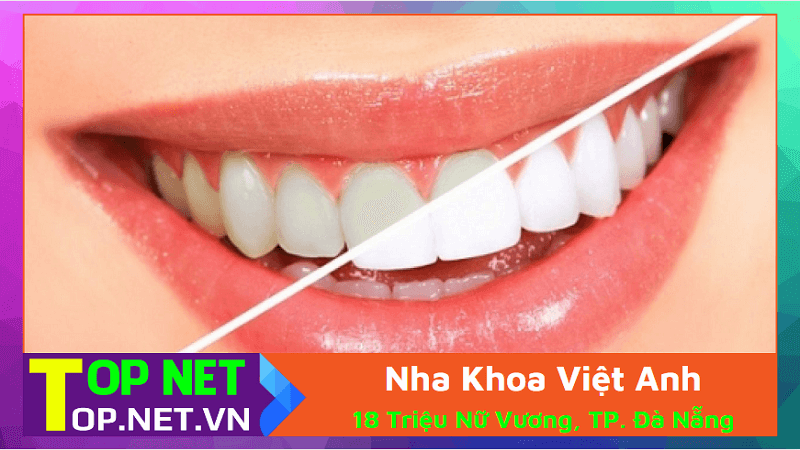 Nha Khoa Việt Anh - Tẩy trắng răng tại Đà Nẵng